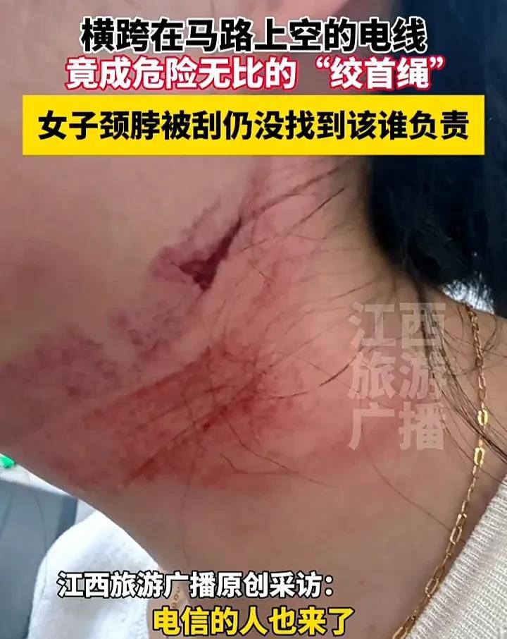 太倒霉了！6月26日，江苏苏州一名女子骑电动车过马路时，突然被上方掉下来的电线勒