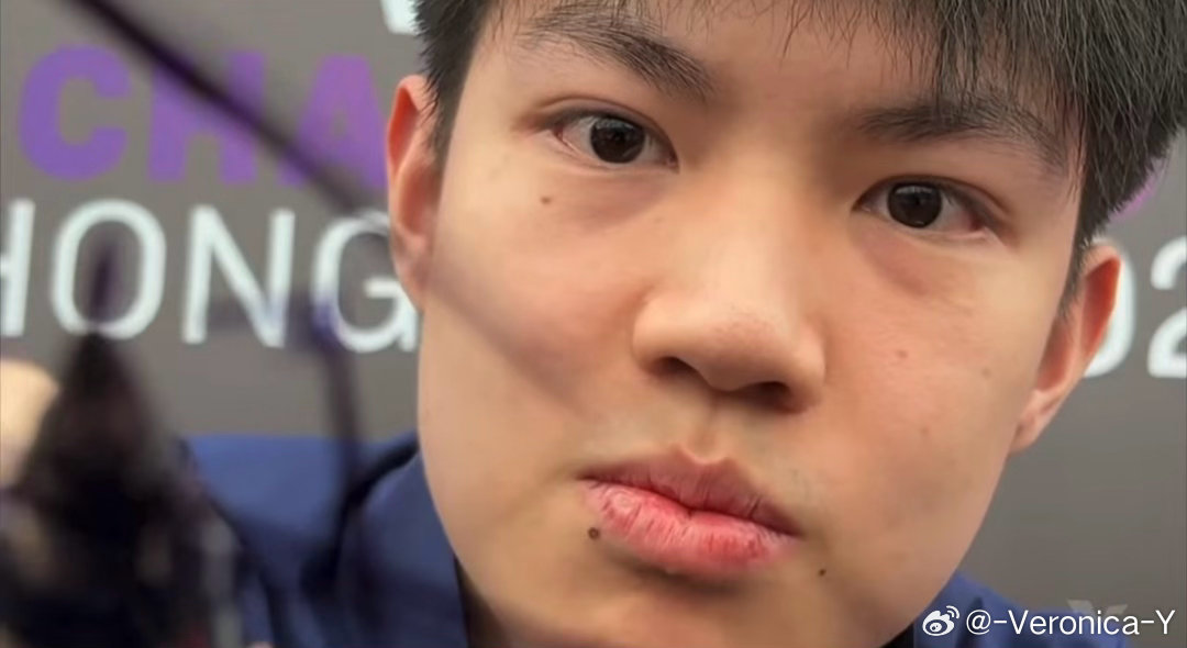 年轻人这皮肤就是好啊而且鼻子是鼻子眼睛是眼睛的长得多清楚