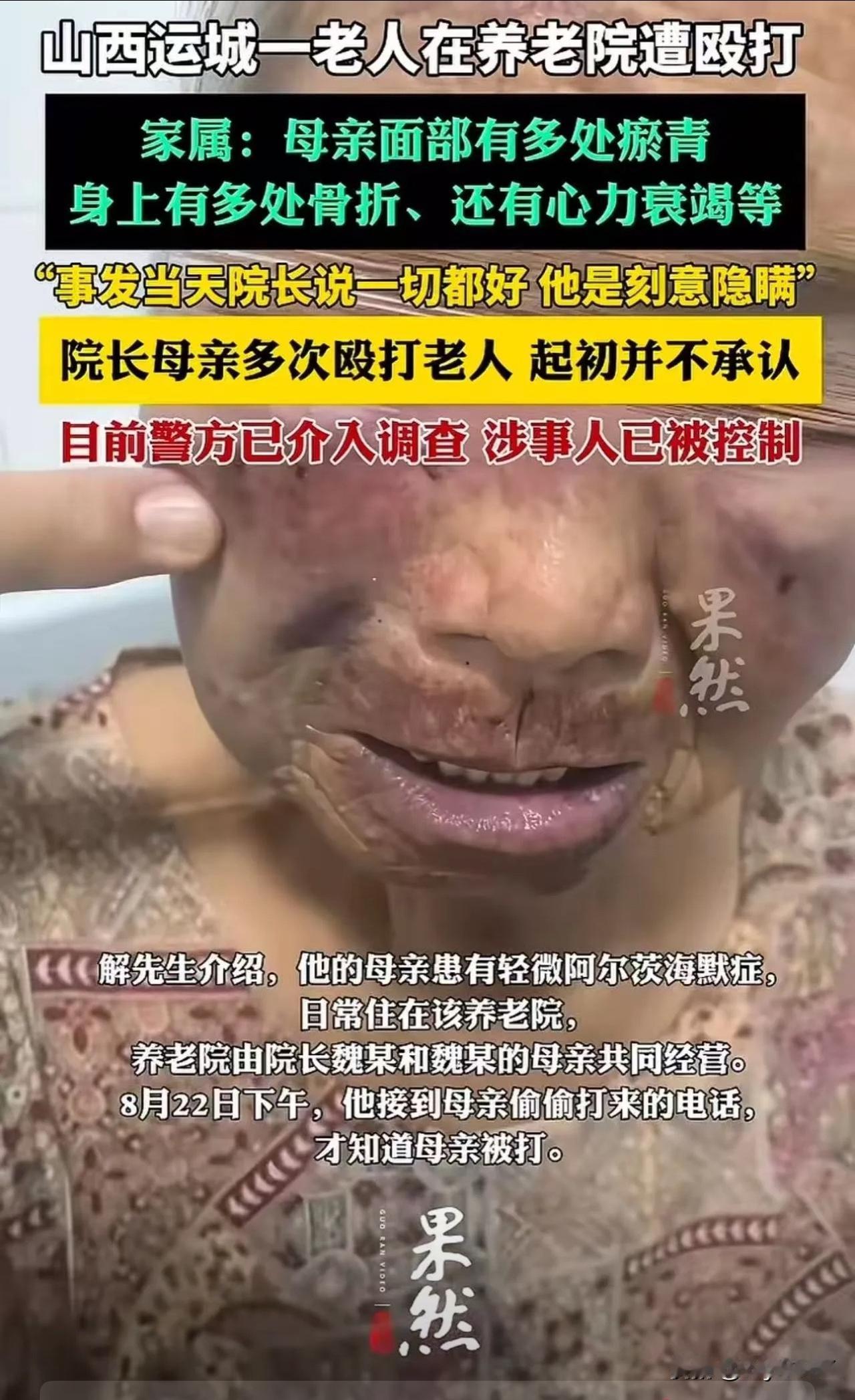 山西运城，八旬老人偷偷给儿子打电话，说自己被养老院院长的母亲从凌晨3点殴打到天亮