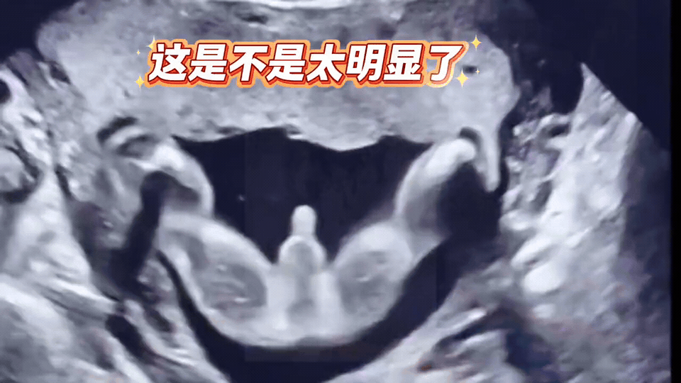 哈哈！小家伙偷偷“提示”妈妈啦🥰这也太明显了~