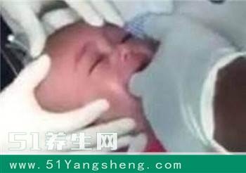 宝宝无声大哭, 医生竟从嘴里取出这东西让人吓出冷汗, 差点窒息