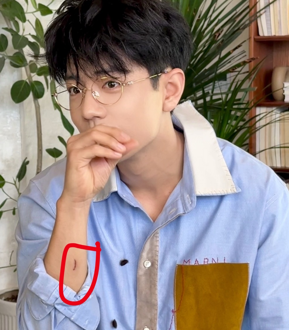 肖战手上有个挺大的伤口[思考]工作室发图片的时候p掉了！肖战工作室仪式感​​