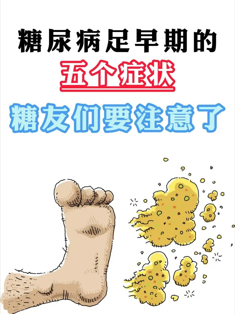 糖尿病足早期5个症状：1、感觉异常，如麻木、刺痛、蚁走感。