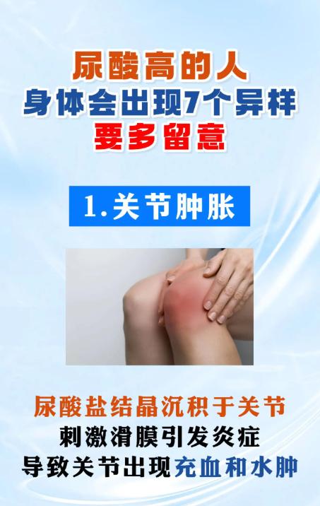 尿酸偏高的人，身体常会出现7个异常信号