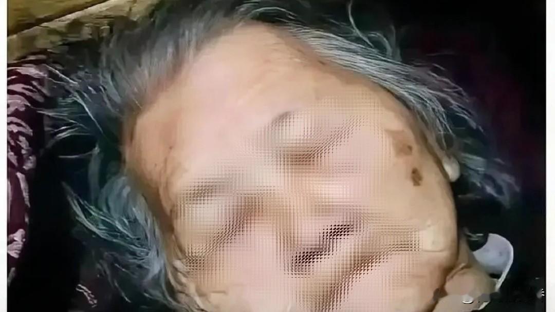 82岁老人酒加头孢离世：那句我拖累你们，不是客气是求救82岁张奶奶趁家中