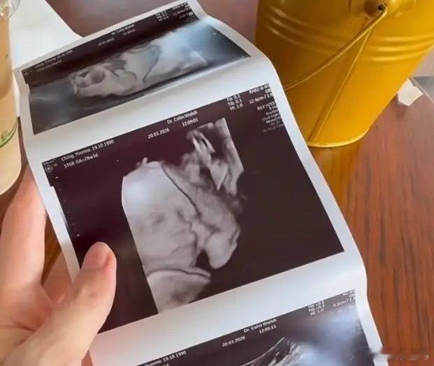 程晓玥挺大肚子晒二胎产检照，小宝宝照B超显示高鼻梁，颜值好高。她在澳洲顺利通过2