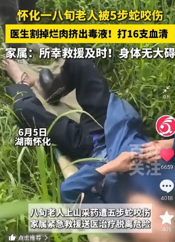 湖南怀化，80岁老人上山采药，被五步蛇咬伤，医生割掉了烂肉，又挤出毒液，最后打了