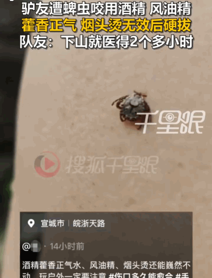 太可怕了！6月17日中原网报道，安徽宣城，一男子徒步至半山腰时，不幸被蜱虫紧紧咬
