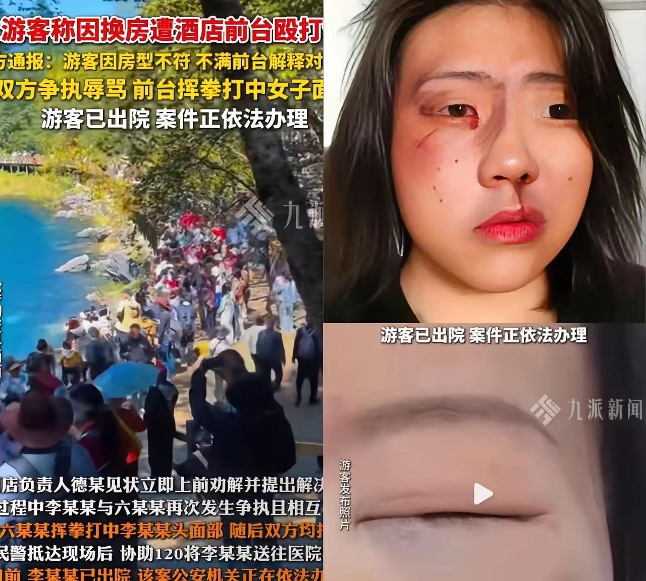 她先打人，被打活该，人家是正当防卫。