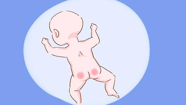 宝宝为啥出现红屁股? 宝妈掌握这4招, 让宝宝跟红屁屁说拜拜