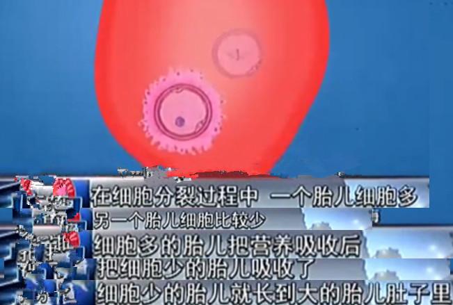 实拍: 初生“男婴怀孕”, 网友: 这怎么可能?