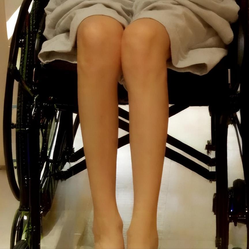 脊髓损伤后肌肉萎缩，这可怎么办？4招帮你解决很多脊髓损伤的朋友发现，受伤后胳