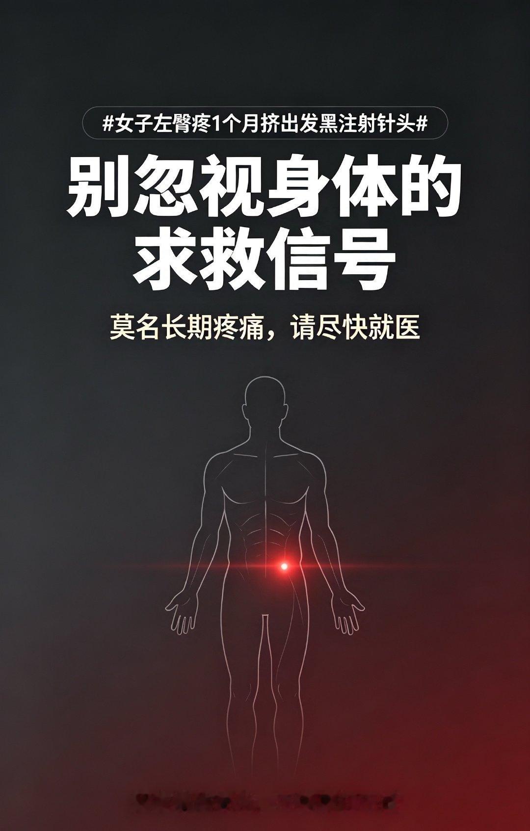 #女子左臀疼1个月挤出发黑注射针头#误以为肌肉拉伤疼了一个月，洗澡挤出4cm生锈黑针头⚠️减肥脂肪变