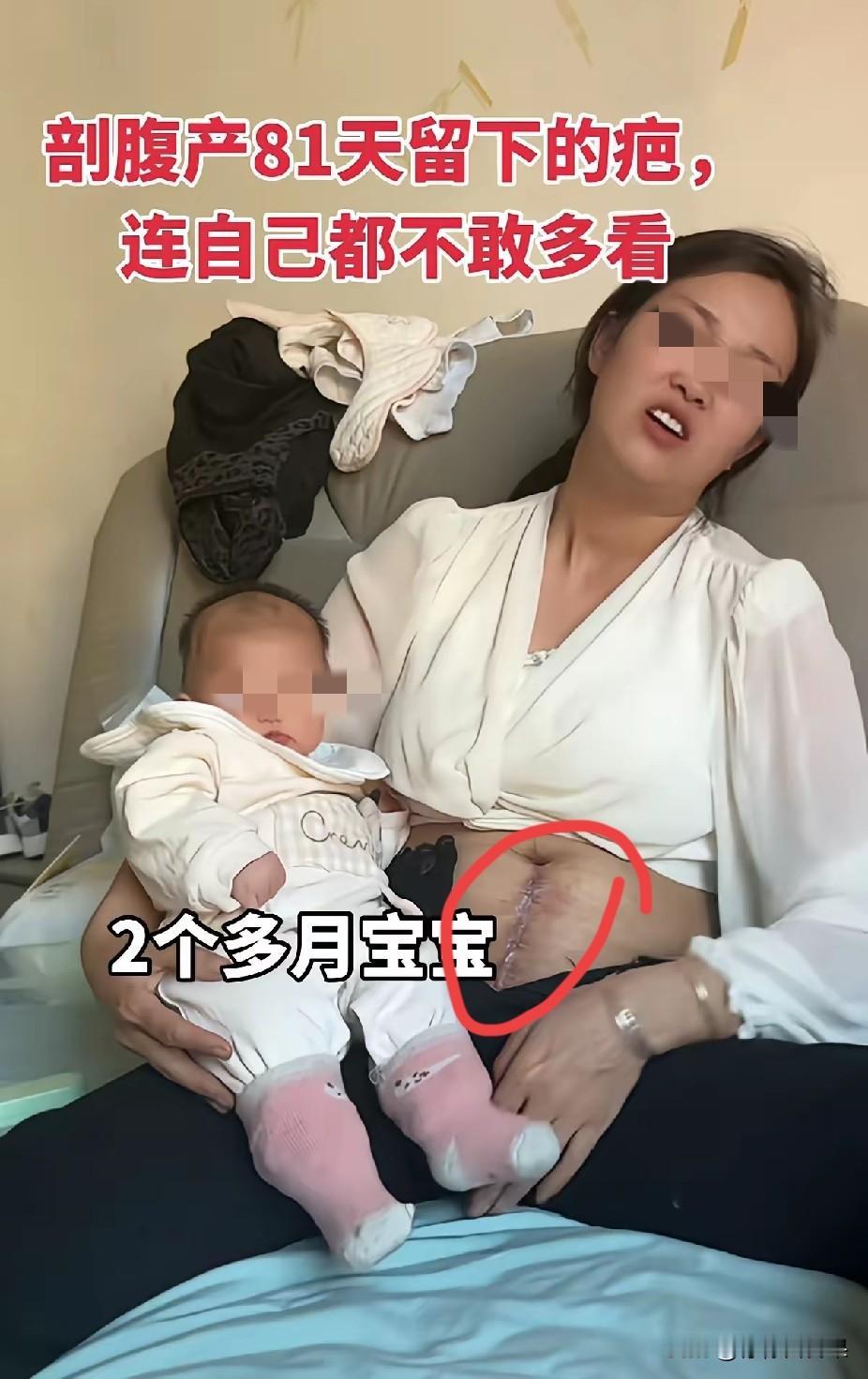很多人以为，生孩子无非就是疼一阵子，宝宝落地就万事大吉。可只有当过妈妈才懂，不