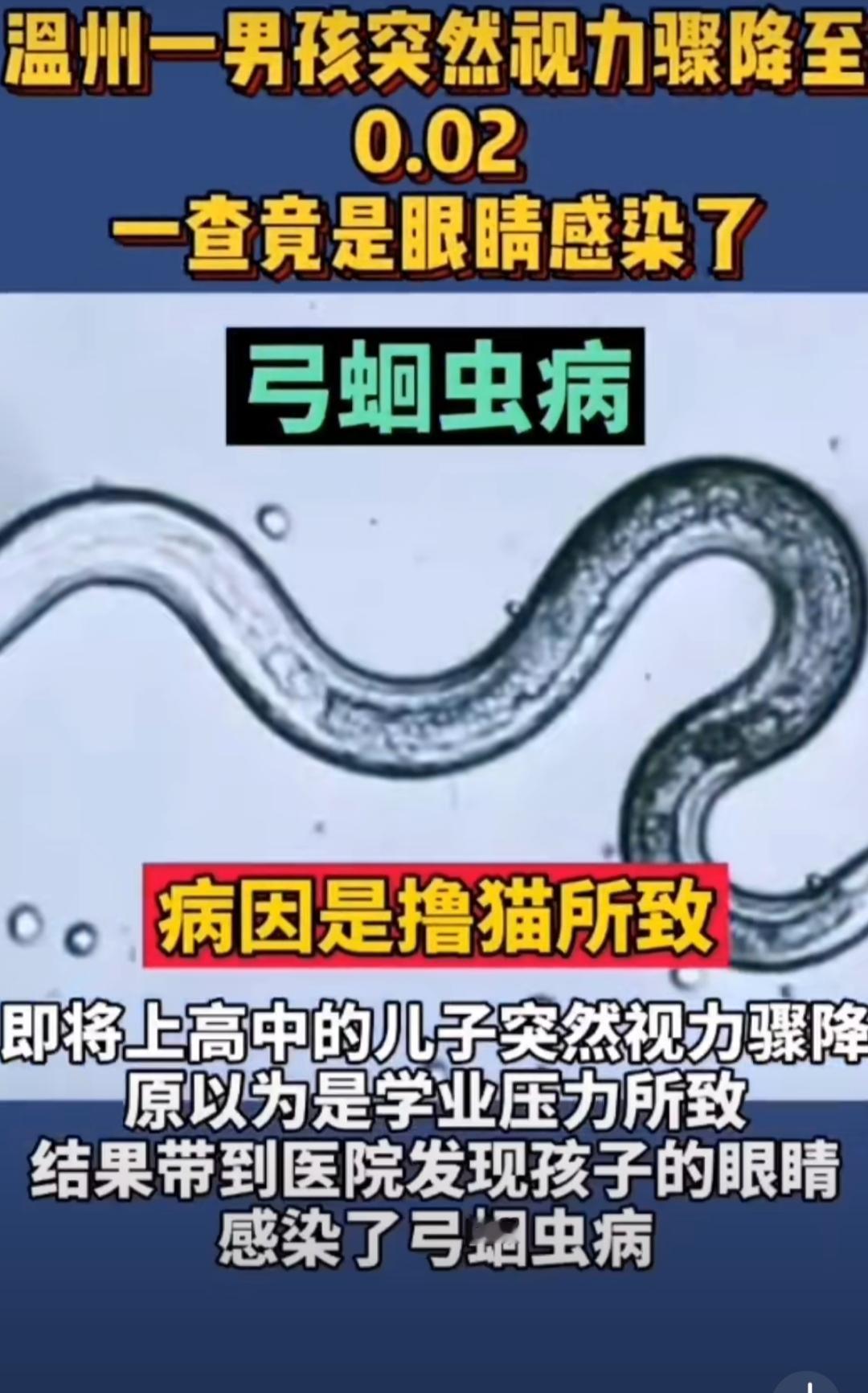河南有个11岁男孩最近成了新闻焦点——他因为天天和家里的猫腻在一起，右眼视力突然