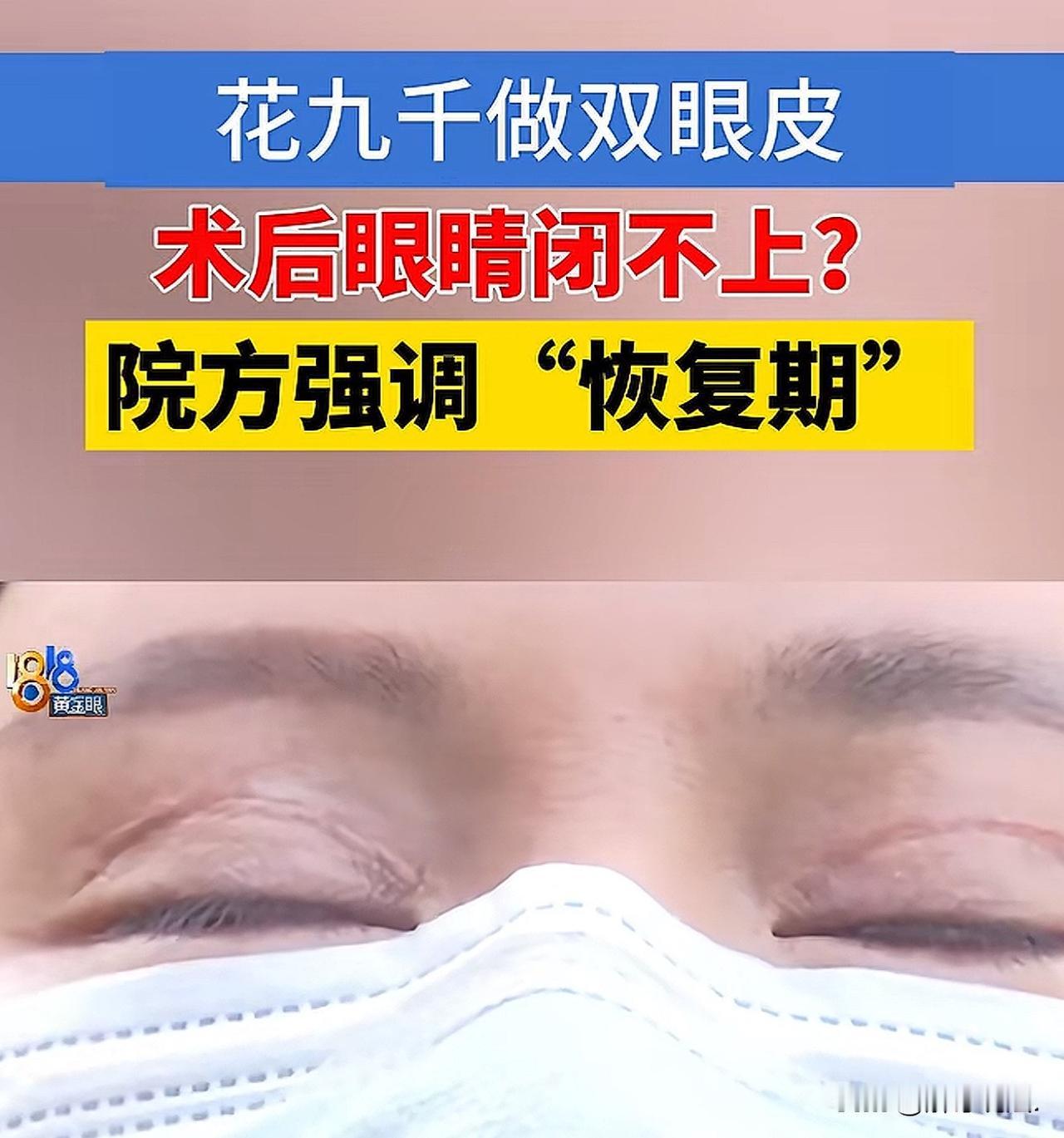 浙江杭州，一女子花9000多元在一家整形医院做了双眼皮手术，结果，手术后的双眼皮