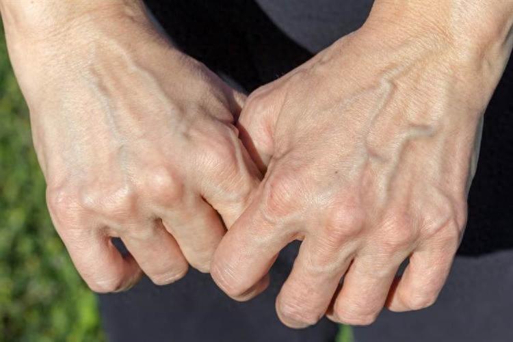 能不能长寿，手背青筋可以看出？医生：若有4特征，长寿几率更大手背静脉的状