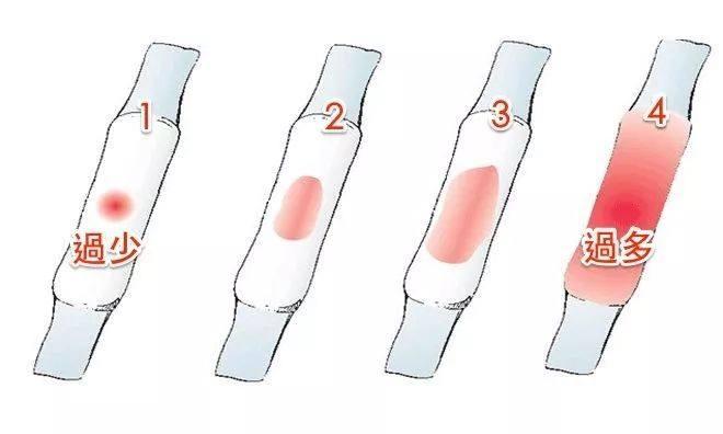 不孕不育|月经量少影响怀孕吗? 经量少的原因都有那些?
