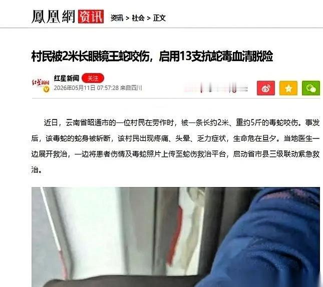 云南一个大哥，一锄头把条2米长的眼镜王蛇，砍成了两截。蛇身在田里还扭着，他擦了把