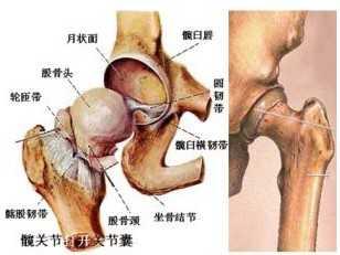 奇穴排瘀调理股骨头坏死的经验分享
