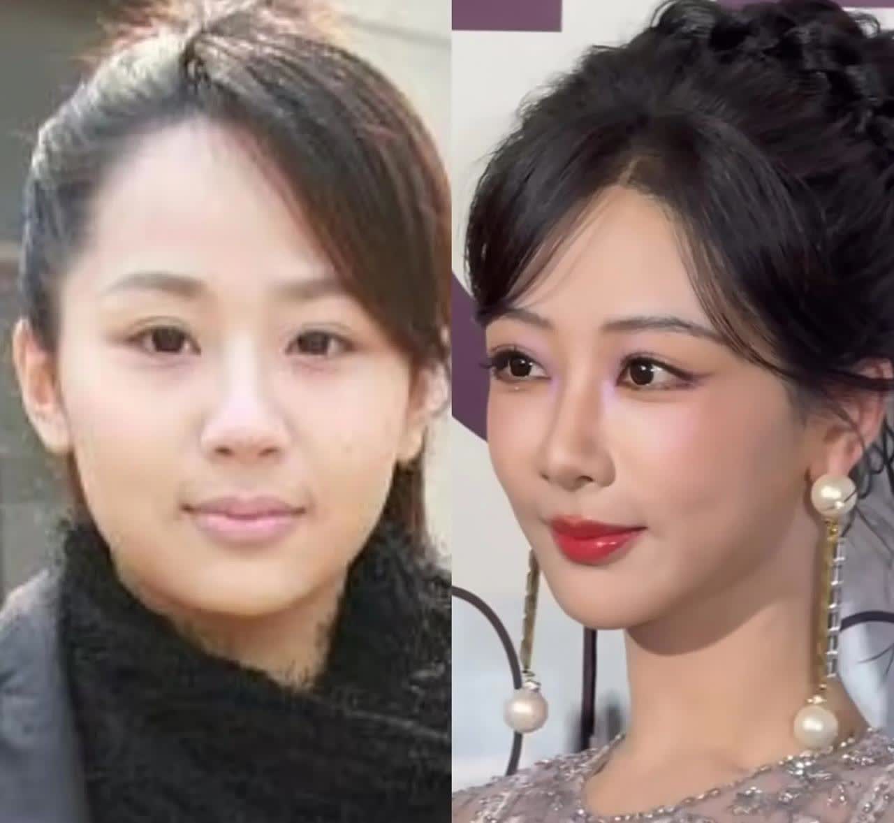 杨紫是否有整容为娱乐圈谜题之一。杨紫作为童星，小时候长什么样都知道，小时