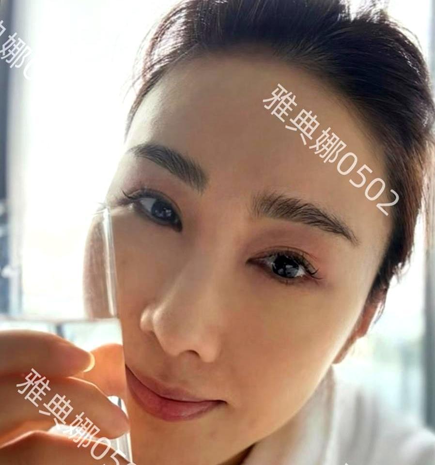 发红包那天，没人看钱，全在看她的脸。苹果肌像两颗抛光的水煮蛋，牢牢焊在颧骨上。