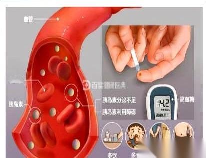 见过把自己活成一块“控糖试验田”的人吗？我身边就有一个姐姐，48岁，当老师的。