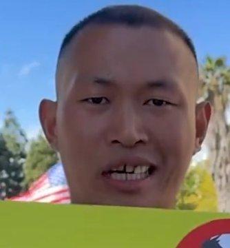 在美国的润人不少都有一个惊人的共同点，缺牙！怪不得总觉的他们说话漏风，每次看到