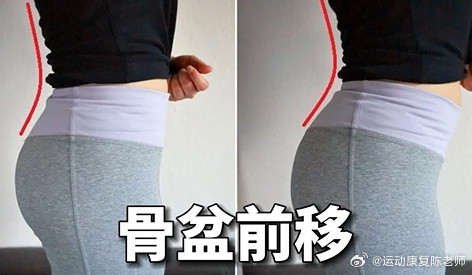 骨盆矫正【呼吸训练与骨盆前移】不胖但小腹突出，而且经常伴随腰痛和胸闷气短，你这
