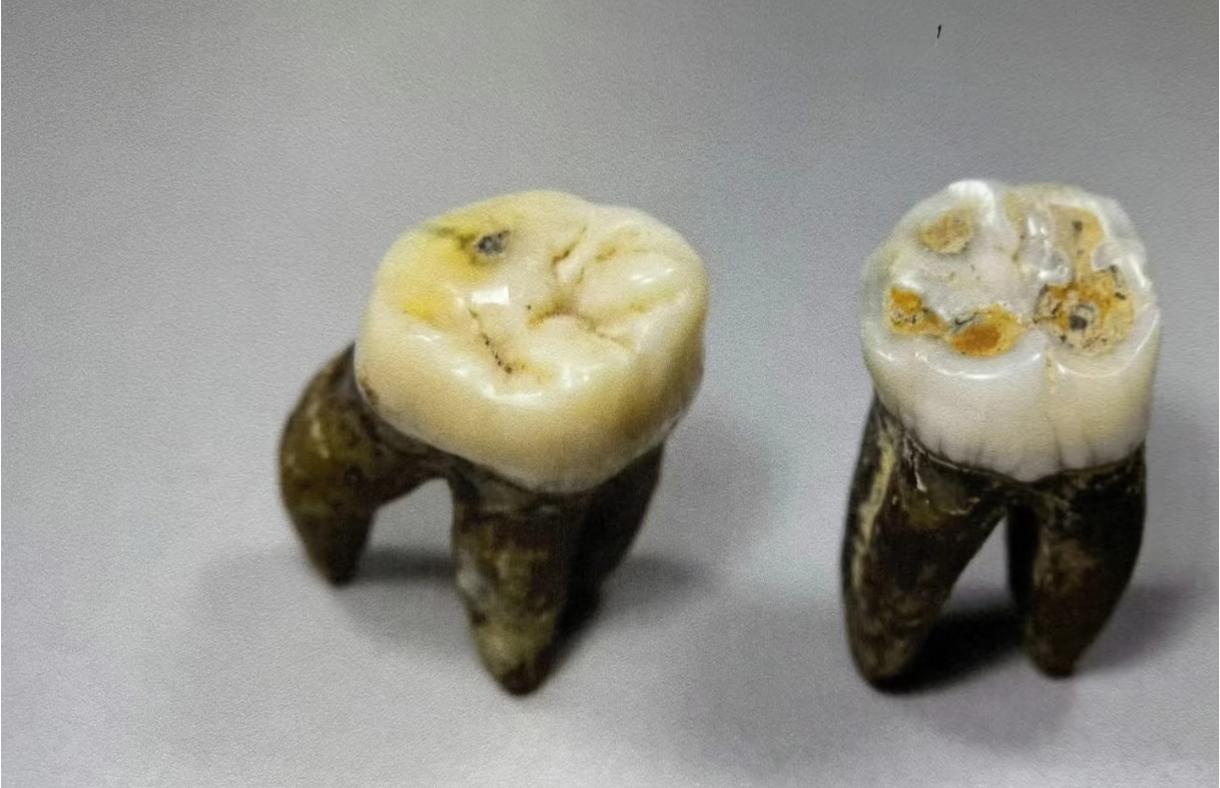 2013年，江苏扬州曹庄村的工地里，一铲子下去挖出了隋炀帝的两颗牙！先说说这