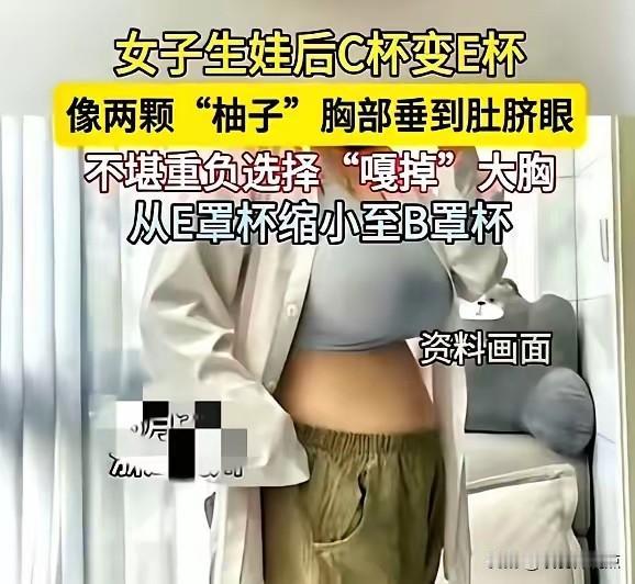 😰杭州妈妈C杯变E杯，勒痕渗血！切除3斤后，她终于“卸了盔甲”杭州32岁赵