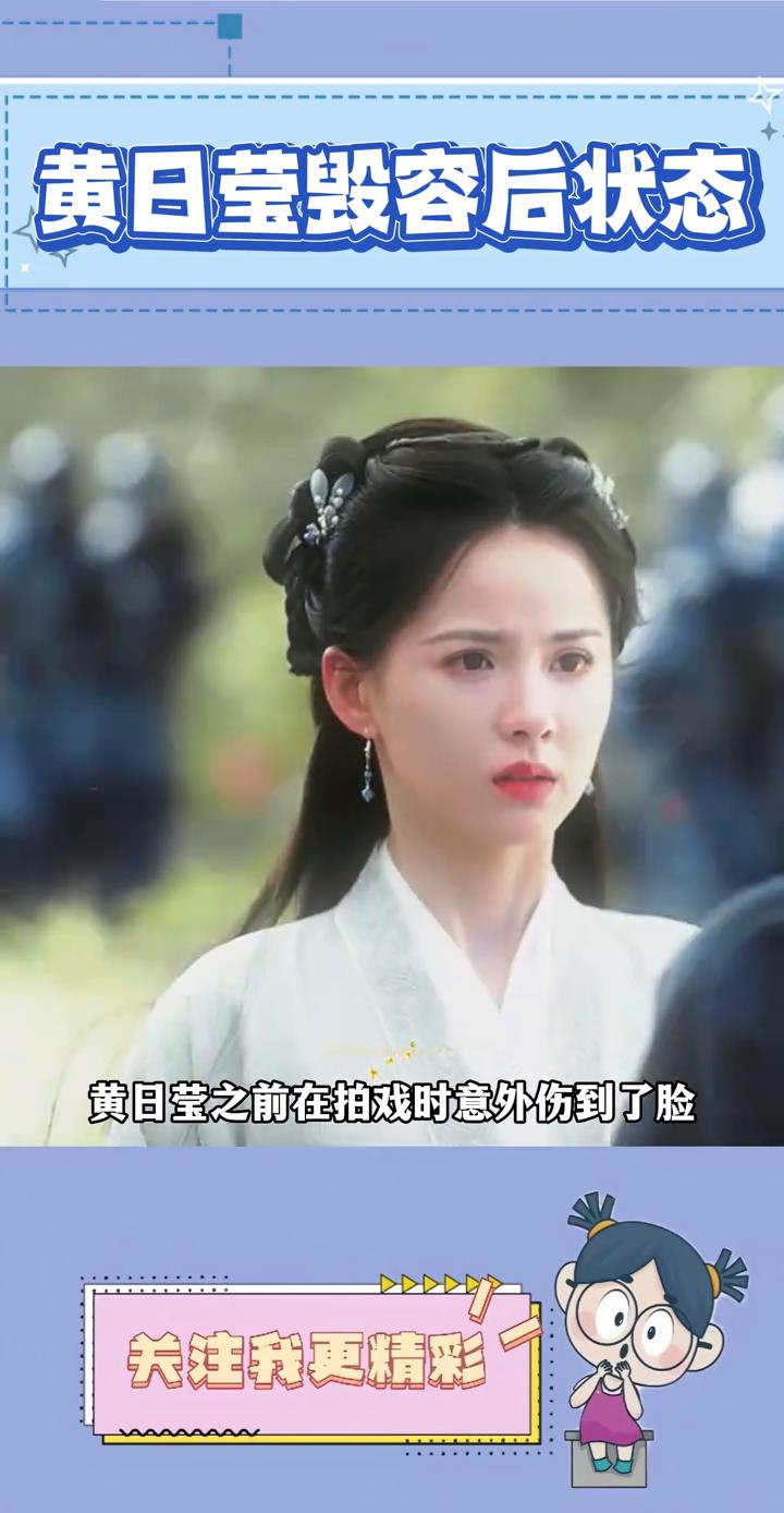 黄日莹毁容后状态。黄日莹恐怕是内娱第一个毁容后颜值却反而翻倍的女演员。黄日莹之