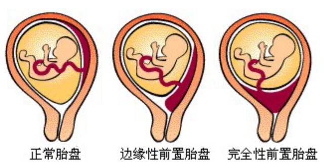 为啥孕妇肚脐有凹有凸? 4个主要原因要知道, 大部分人