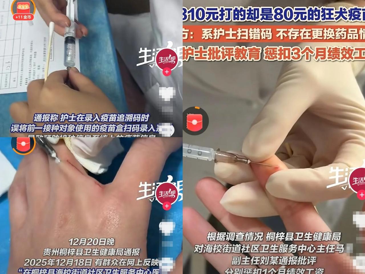 贵州，一男童被狗咬伤，家长赶紧带着孩子去打狂犬疫苗，为了安全起见，选择了310元