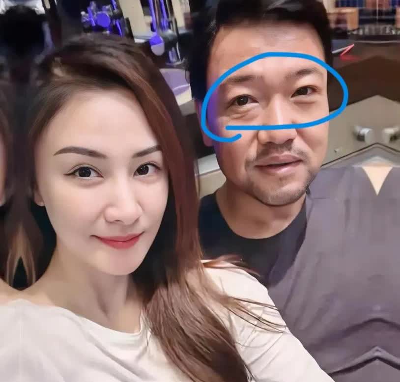 45天狂甩45斤！贾冰暴瘦惊现'垮脸'危机，网友炸锅：这减肥速度太吓人！