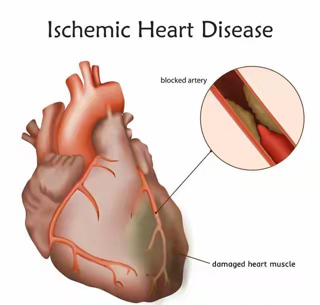 浙江宁波，一小伙为了增强免疫力，每天晚上都要跑步，结果这晚他跑出去400米，就感