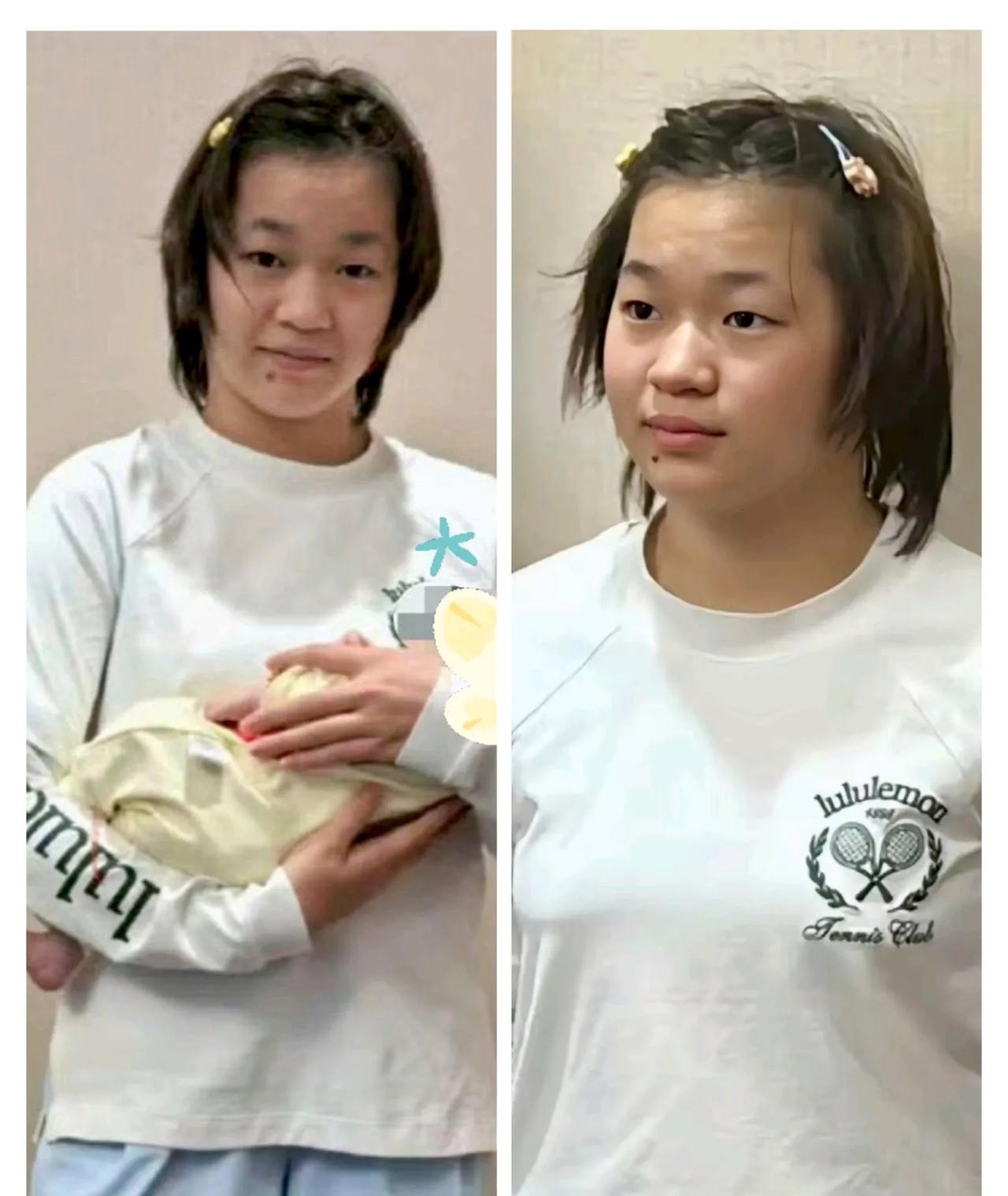 网上流传的全红婵近照，不管是脸还是身材，明显能看出消瘦了不少。可见这段时间