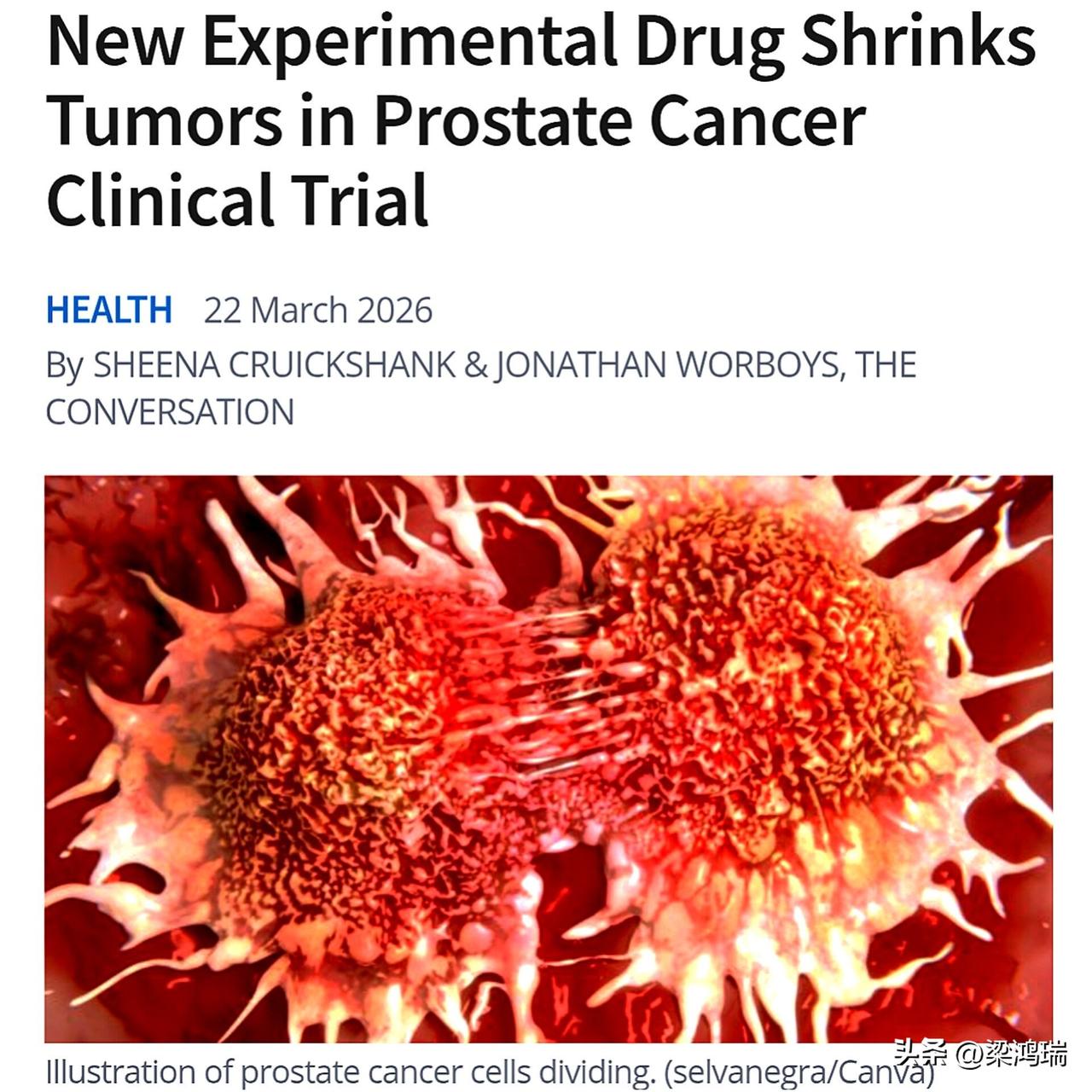 一种名为VIR-5500的新型前列腺癌药物，在其他疗法失败的情况下，已显示出