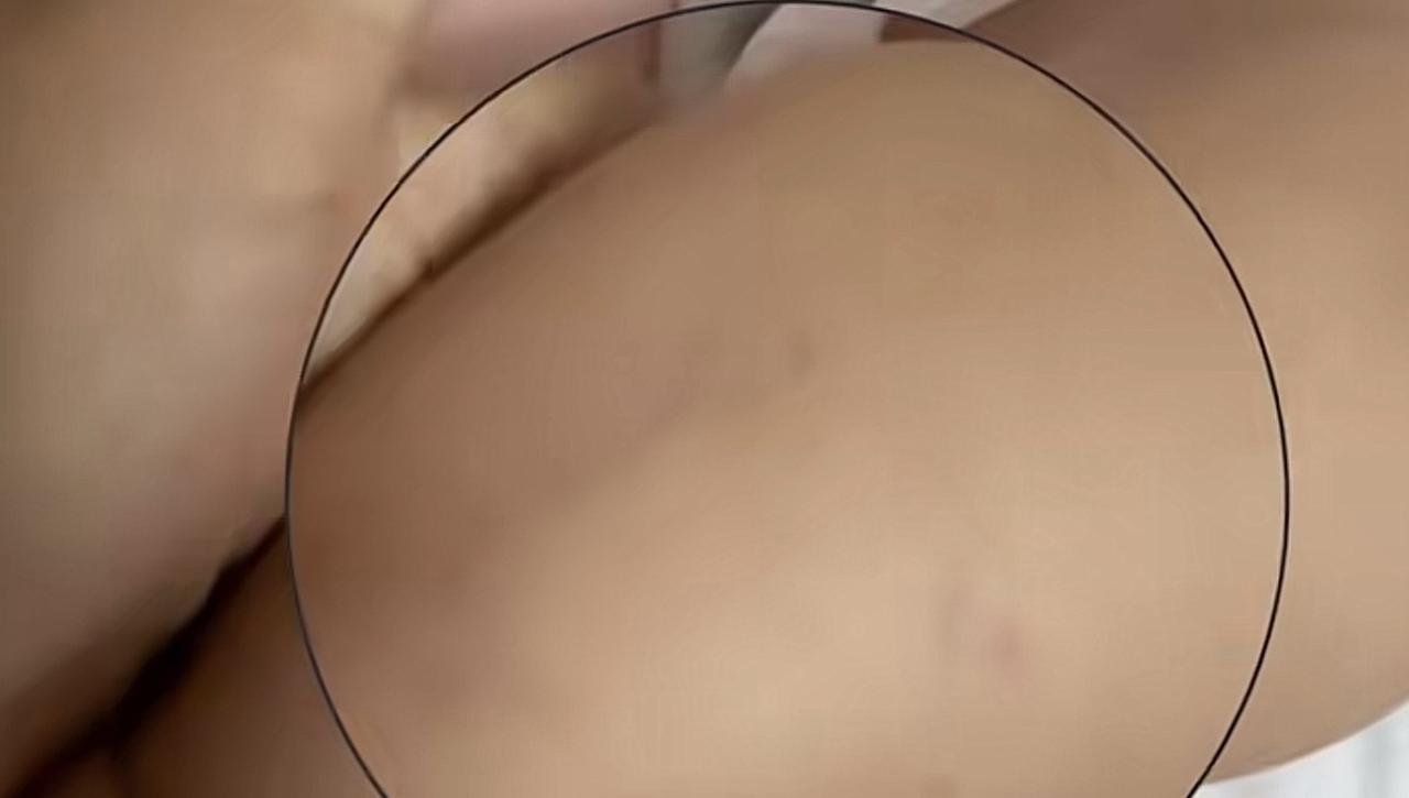 最近有个事儿让不少当爸妈的心里直犯嘀咕——有个小宝宝刚办完百日宴，腿上突然出现一