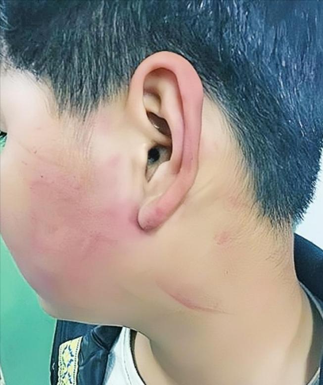 2019年，四川一名校长，因学生调皮，扇了他几巴掌，被孩子母亲逼着赔礼道歉。不料