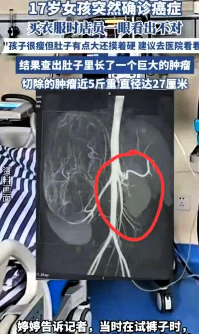 2025年6月，广东17岁女孩和妈妈一起逛街买衣服，在试裤子的时候，老板娘发觉女