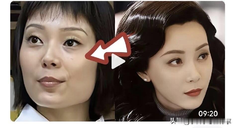 估计她是娱乐圈里医美最成功的一位，清纯的脸庞，精致的五官，脸型圆润流畅，让女人看