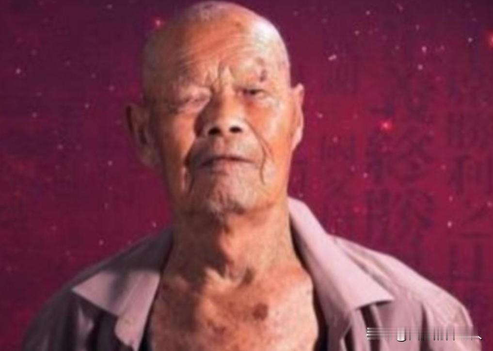 1956年，35岁农民咳嗽10年，竟拒绝就医，一天，他突然用力咳嗽，“哇”的一声