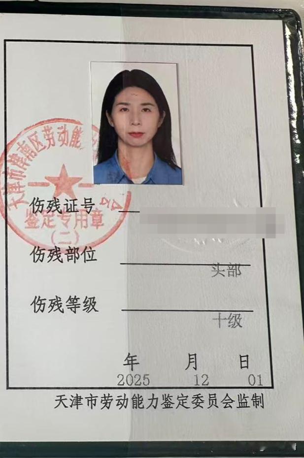 别光盯着崔丽丽拿到十级伤残鉴定拍手称快，换个角度看这事，细思极恐！明明是王豪强闯