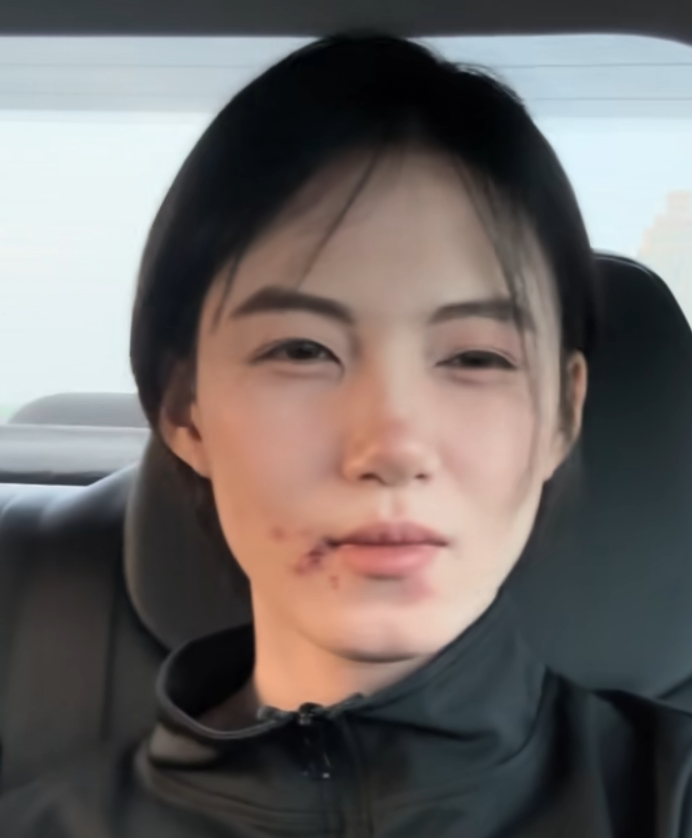 喂你上次说养我是不是真的？（疱疹版）