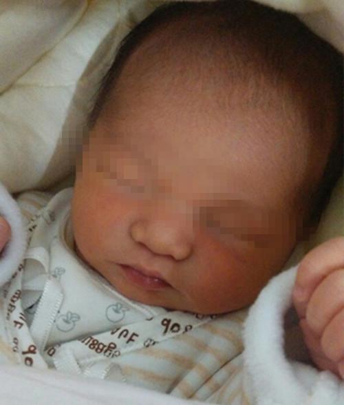 3个月宝宝眼屎多, 医生治疗时妈妈哭求放弃, 爸爸一巴掌打醒妈妈