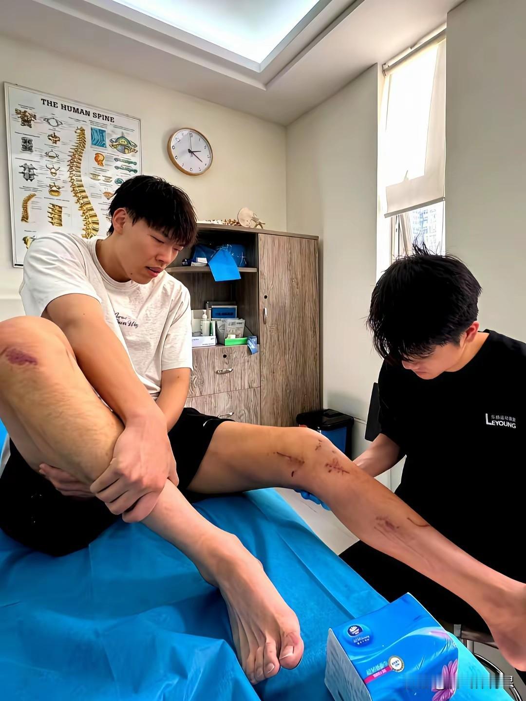 CBA弹簧人张昊伤情曝光，未来或被租借NBL联赛打球。张昊年仅24岁，