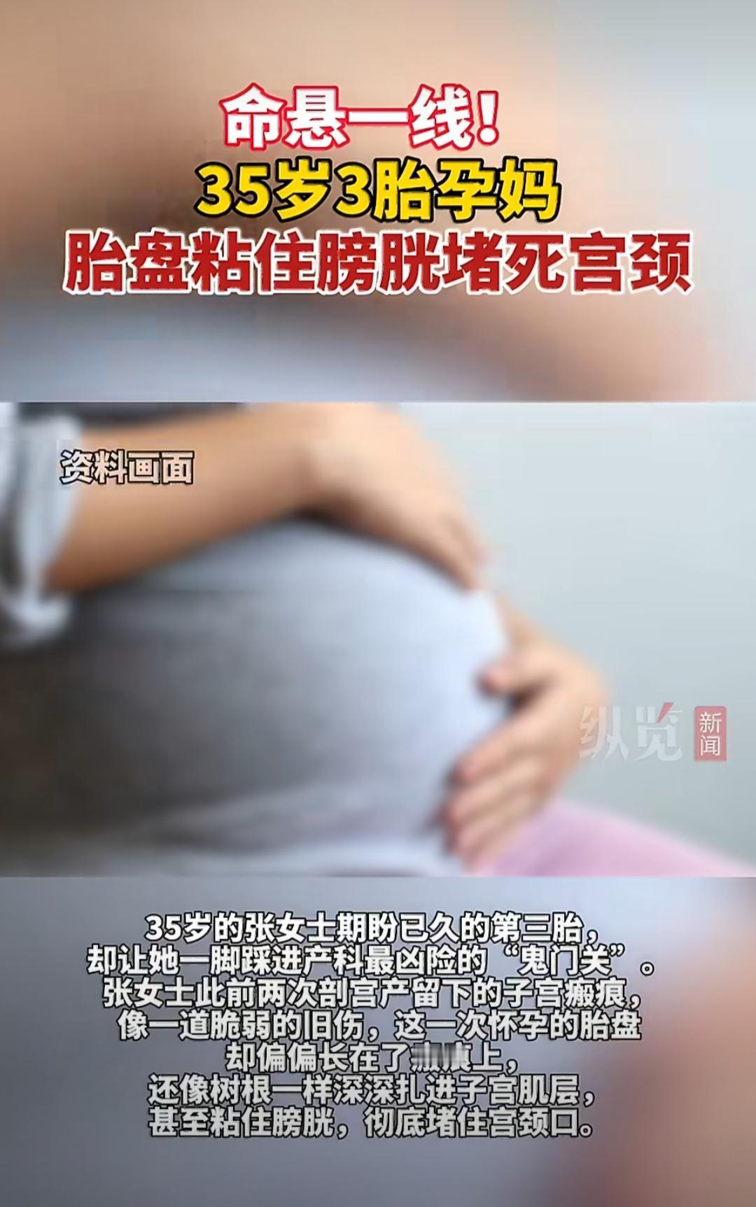 最近有个挺让人揪心的事儿，35岁的张女士怀了第三胎，这本该是件喜事，结果却差点闯