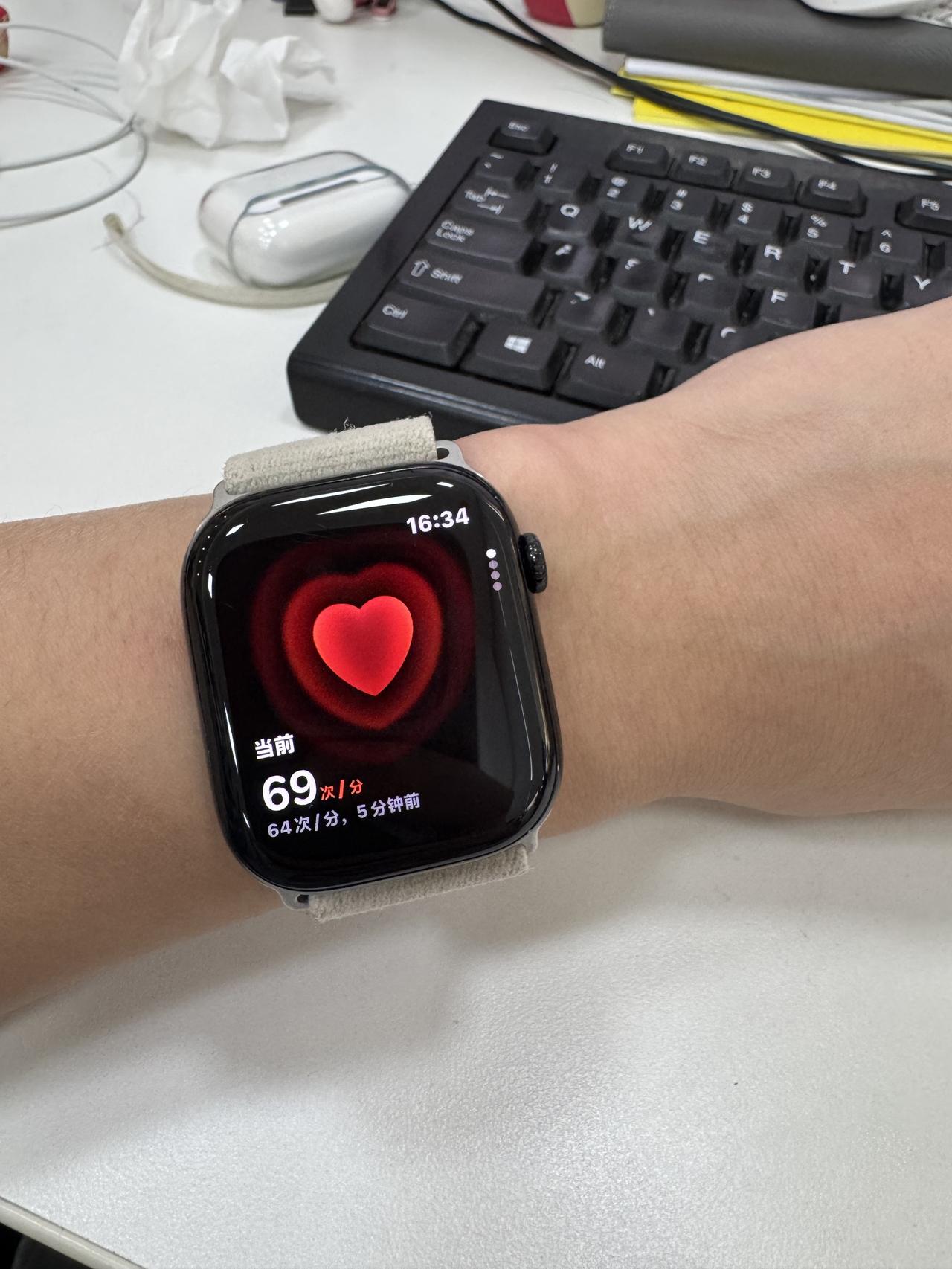 AppleWatch的“房颤历史”功能终于拿到国家药品监督管理局的进口医疗器械