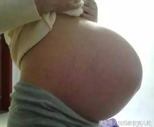 孕妇十月怀胎生下健康二宝, 医生出来报喜后, 公婆却转身离开